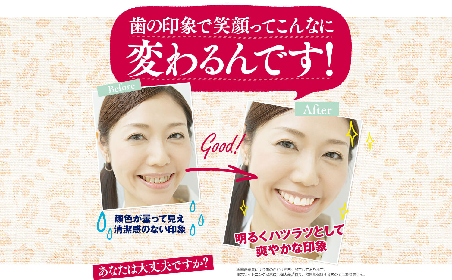 薬用ちゅらトゥースホワイトニング　歯の印象で笑顔ってこんなに変わるんです！