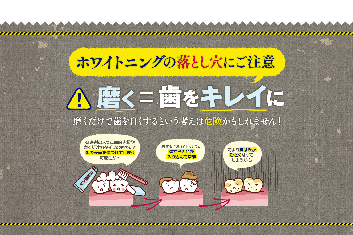 薬用ちゅらトゥースホワイトニング　ホワイトニングの落とし穴にご注意