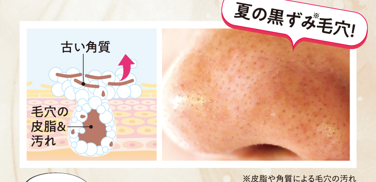夏の黒ずみ毛穴