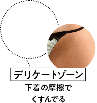 デリケートゾーン　下着の摩擦でくすんでる