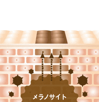 ちゅらゆくる トラネキサム酸